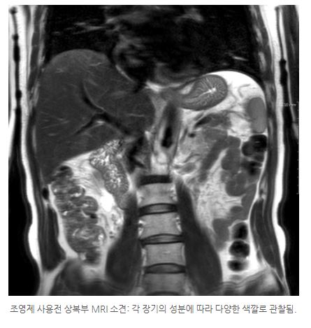 MRI_민트병원.jpg