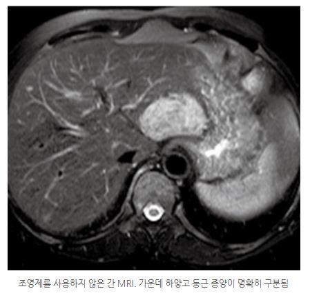 MRI_간_민트병원.jpg